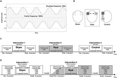 Case report: An N-of-1 study using amplitude modulated transcranial alternating current stimulation between Broca's area and the right homotopic area to improve post-stroke aphasia with increased inter-regional synchrony